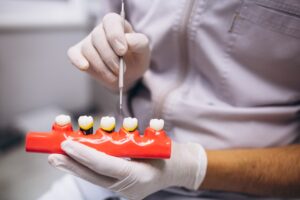 Dentist holding a model of dental crowns